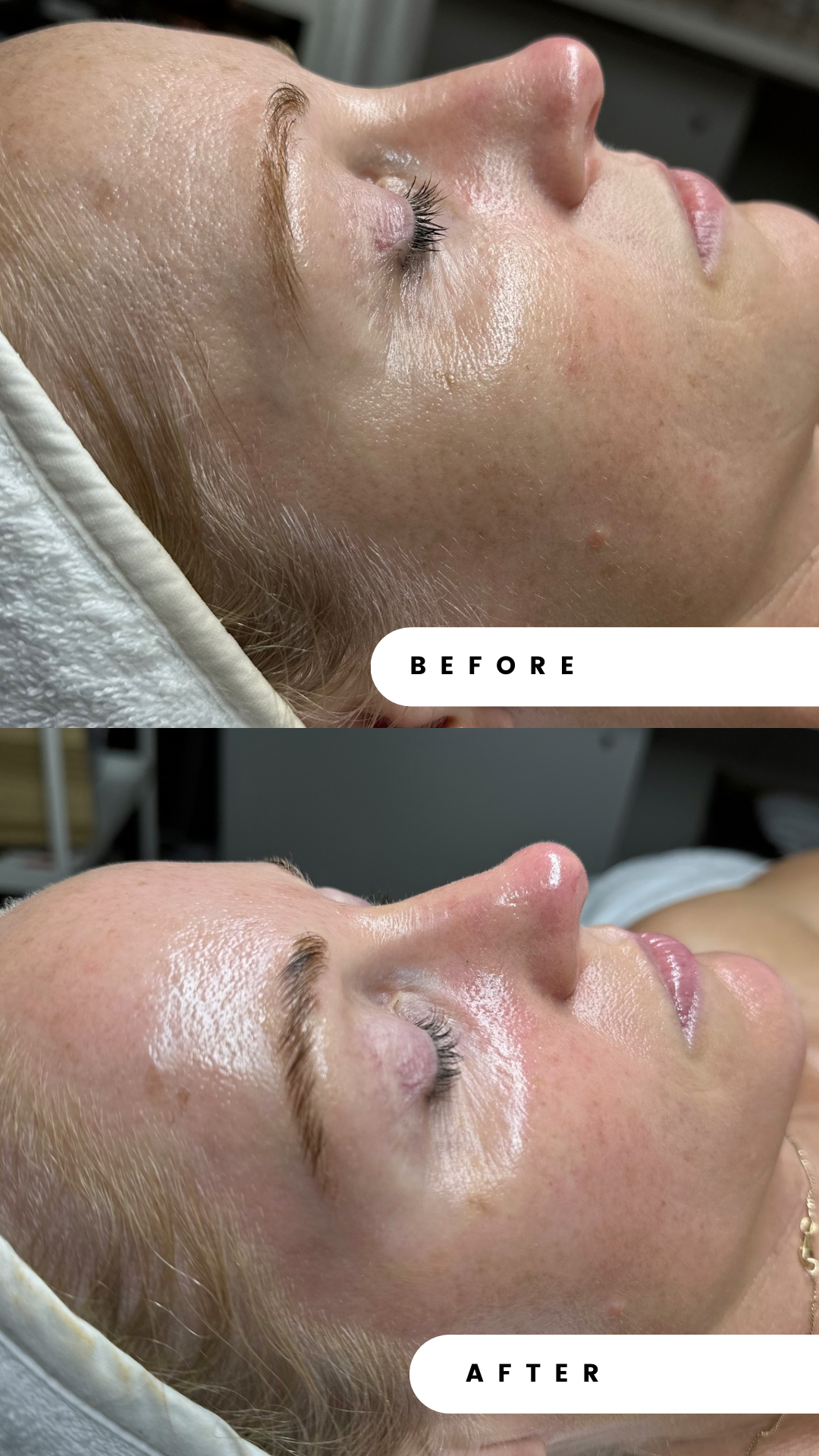 BIORE PEEL SERIES — Get the 4th Peel FREE